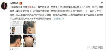 小美弟弟爆料了吗视频在线观看,揭秘幕后真相  第3张 小美弟弟爆料了吗视频在线观看,揭秘幕后真相  第3张